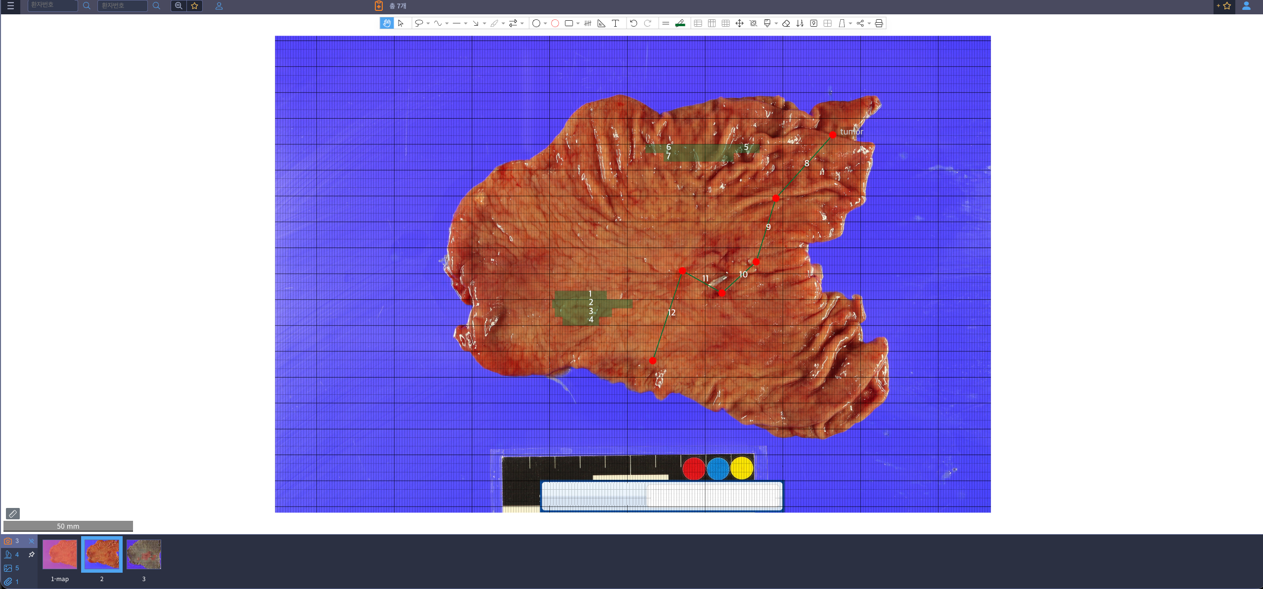 PathEx WSI Viewer 화면